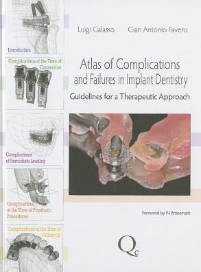 Atlas of Complications and Failures in Implant Dentistry: Guidelines for a Therapeutic Approach