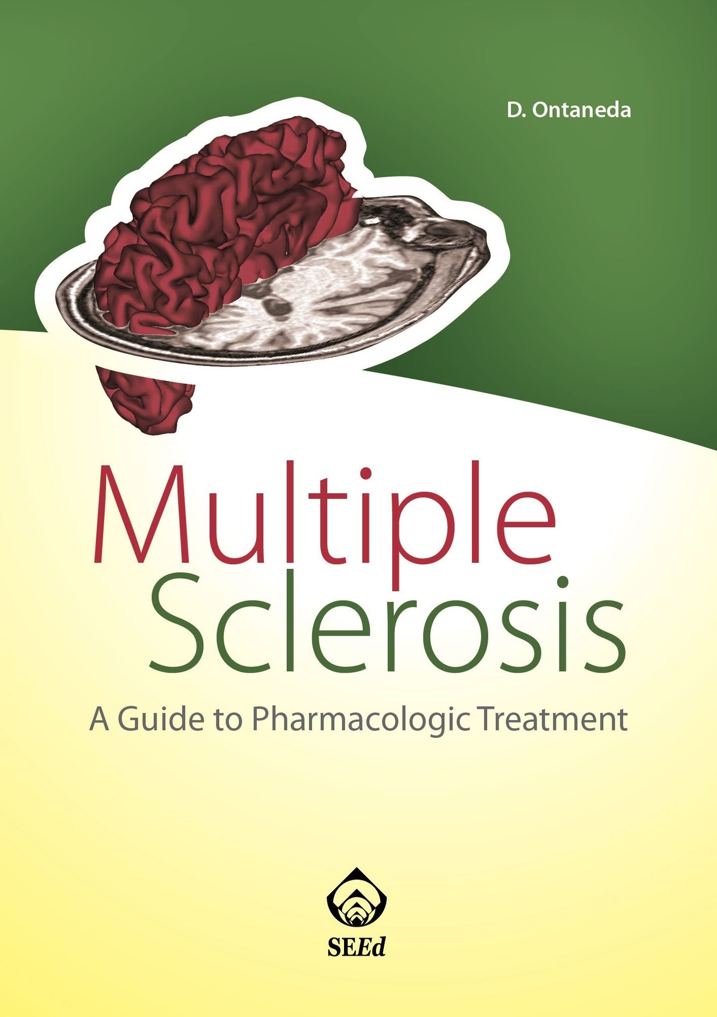 Multiple Sclerosis: A Guide to Pharmacologic Treatment
