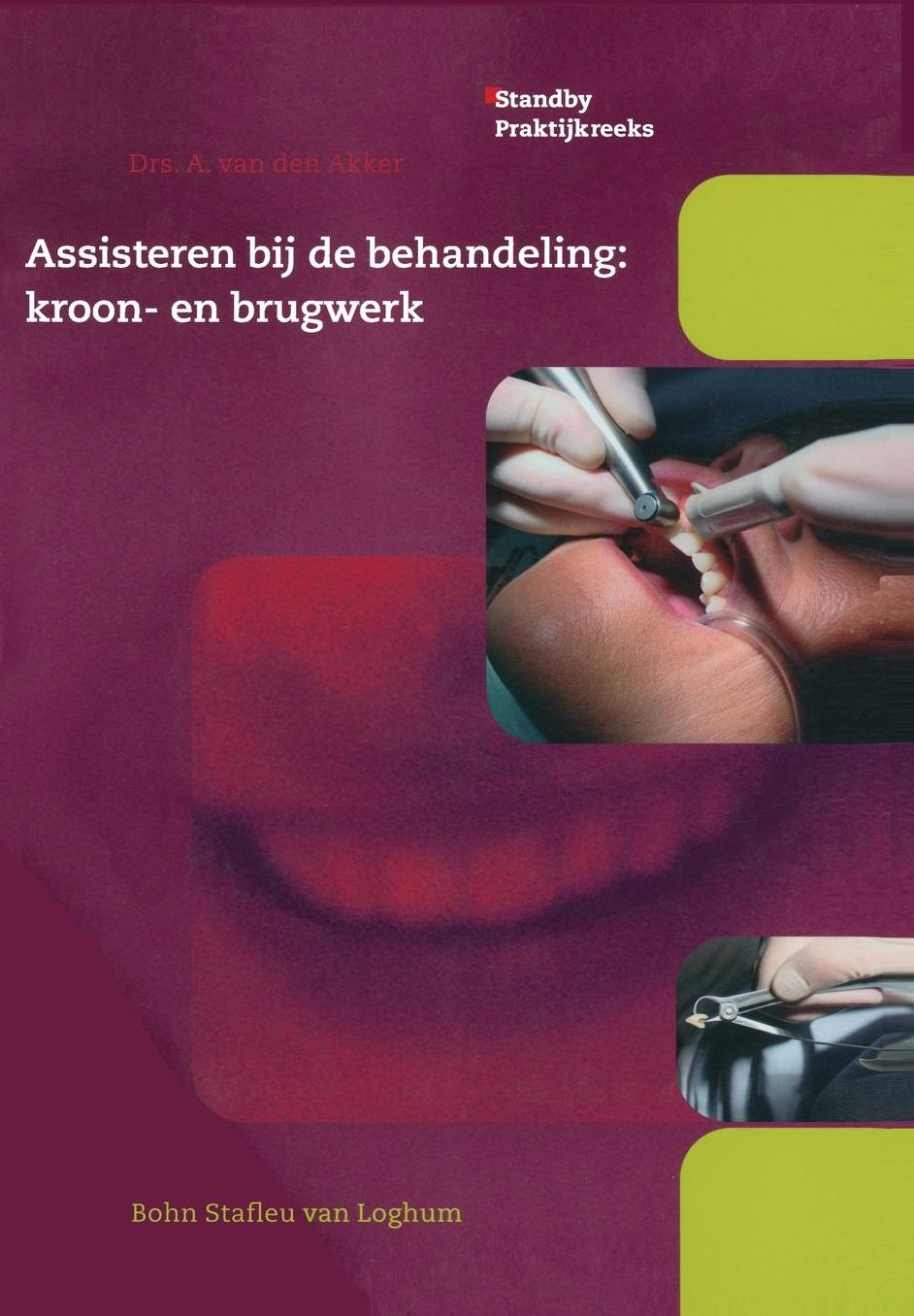 Assisteren bij de behandeling:kroon- en brugwerk