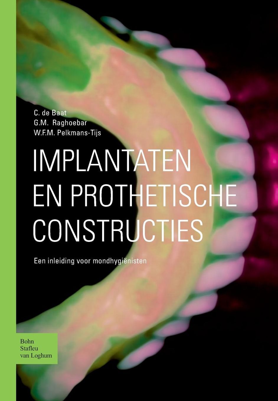 Implantaten En Prothetische Constructies: Een Inleiding Voor Mondhygienisten