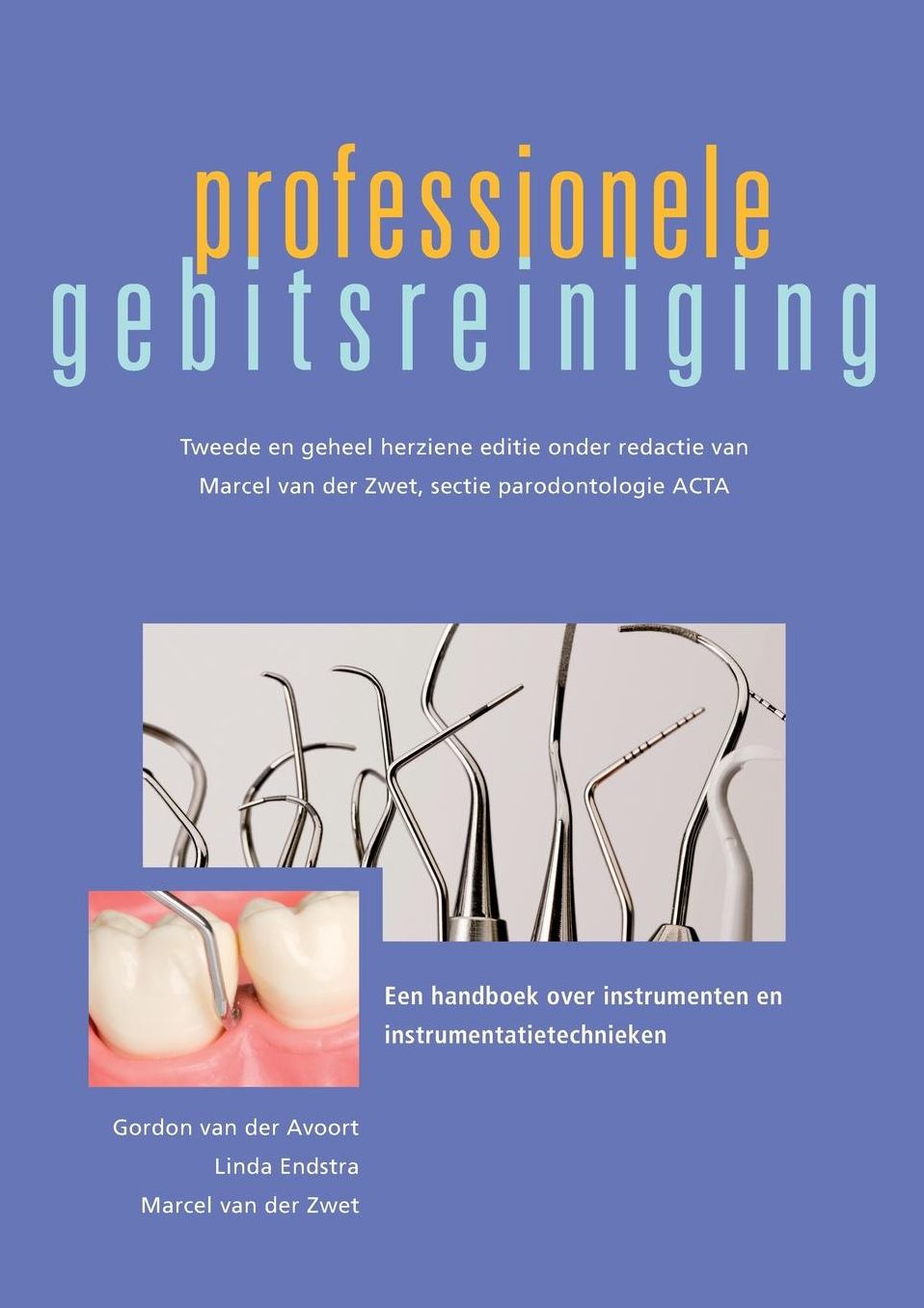 Professionele gebitsreiniging: Een handboek over instrumenten en instrumentatietechnieken