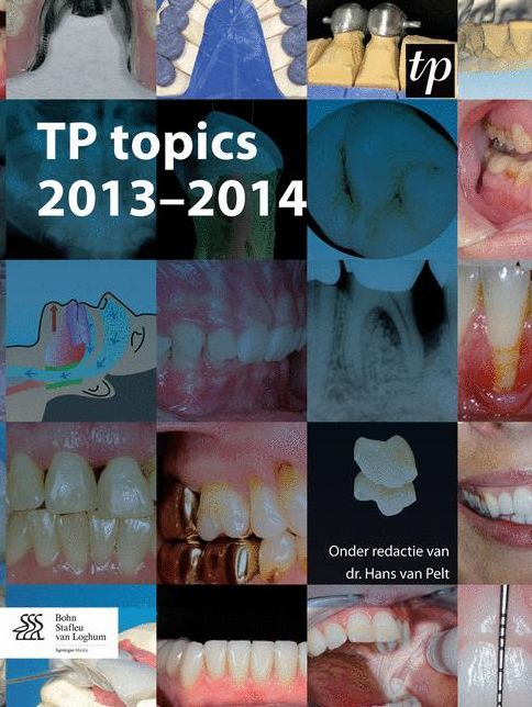 TP topics 2013-2014