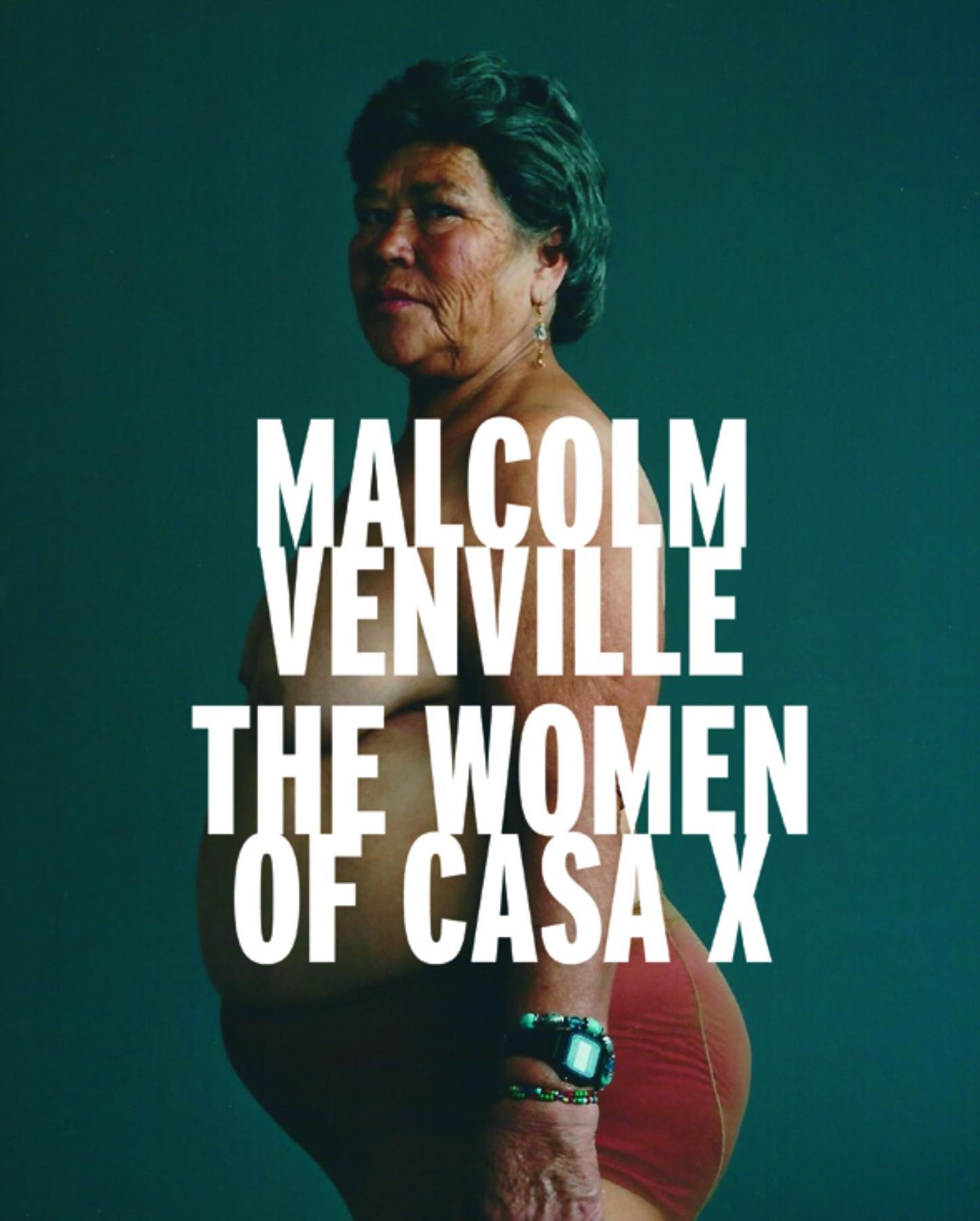 The Women Of Casa X
