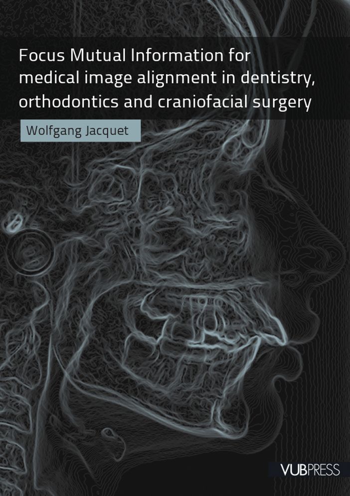Focus Mutual Information for Medical Image Alignment in Dentistry, Orthodontics and Craniofacial Surgery