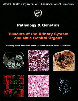 Pathology and Genetics of Tumours of the Urinary System and Male Genital Organs