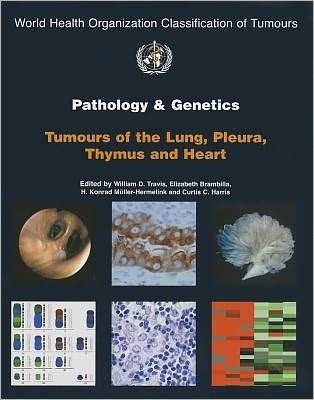 Pathology and Genetics of Tumours of the Lung, Pleura, Thymus and Heart
