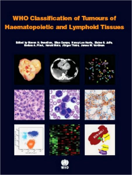 WHO Classification of Tumours of Haematopoietic and Lymphoid Tissue