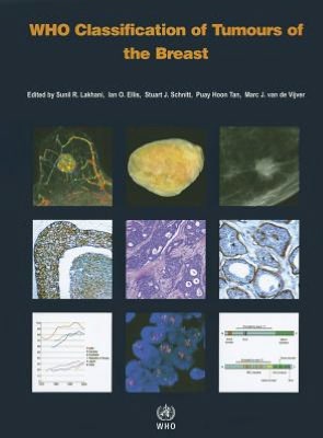 WHO Classification of Tumours of the Breast