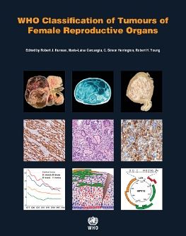 WHO Classification of Tumours of the Female Reproductive Organs