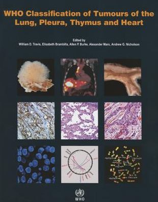 WHO Classification of Tumours of the Lung, Pleura, Thymus and Heart