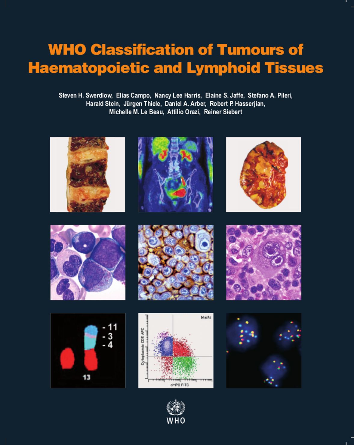 WHO Classification of Tumours of Haematopoietic and Lymphoid Tissues