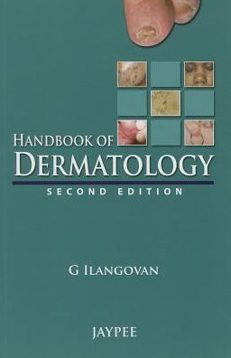 Handbook of Dermatology