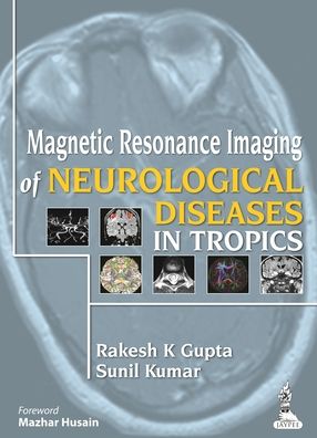 Magnetic Resonance Imaging of Neurological Diseases in Tropics