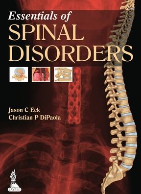 Essentials of Spinal Disorders