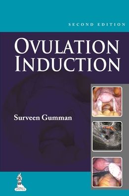 Step by Step Ovulation Induction