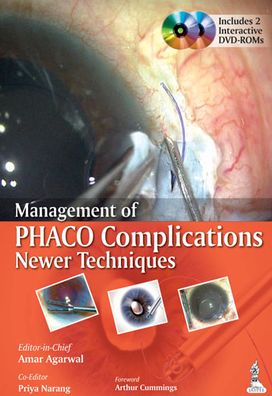 Management of Phaco Complications: Newer Techiques