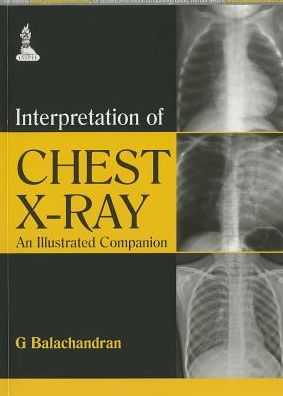 Interpretation of Chest X-Ray: An Illustrated Companion