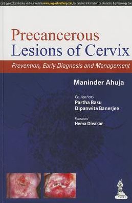 Precancerous Lesions of Cervix: Prevention, Early Diagnosis and Management
