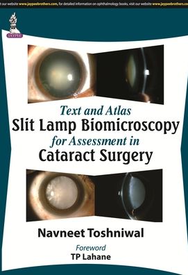 Text and Atlas Slit Lamp Biomicroscopy for Assessment in Cataract Surgery