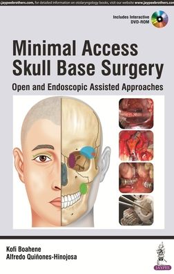 Minimal Access Skull Base Surgery : Open and Endoscopic Assisted Approaches