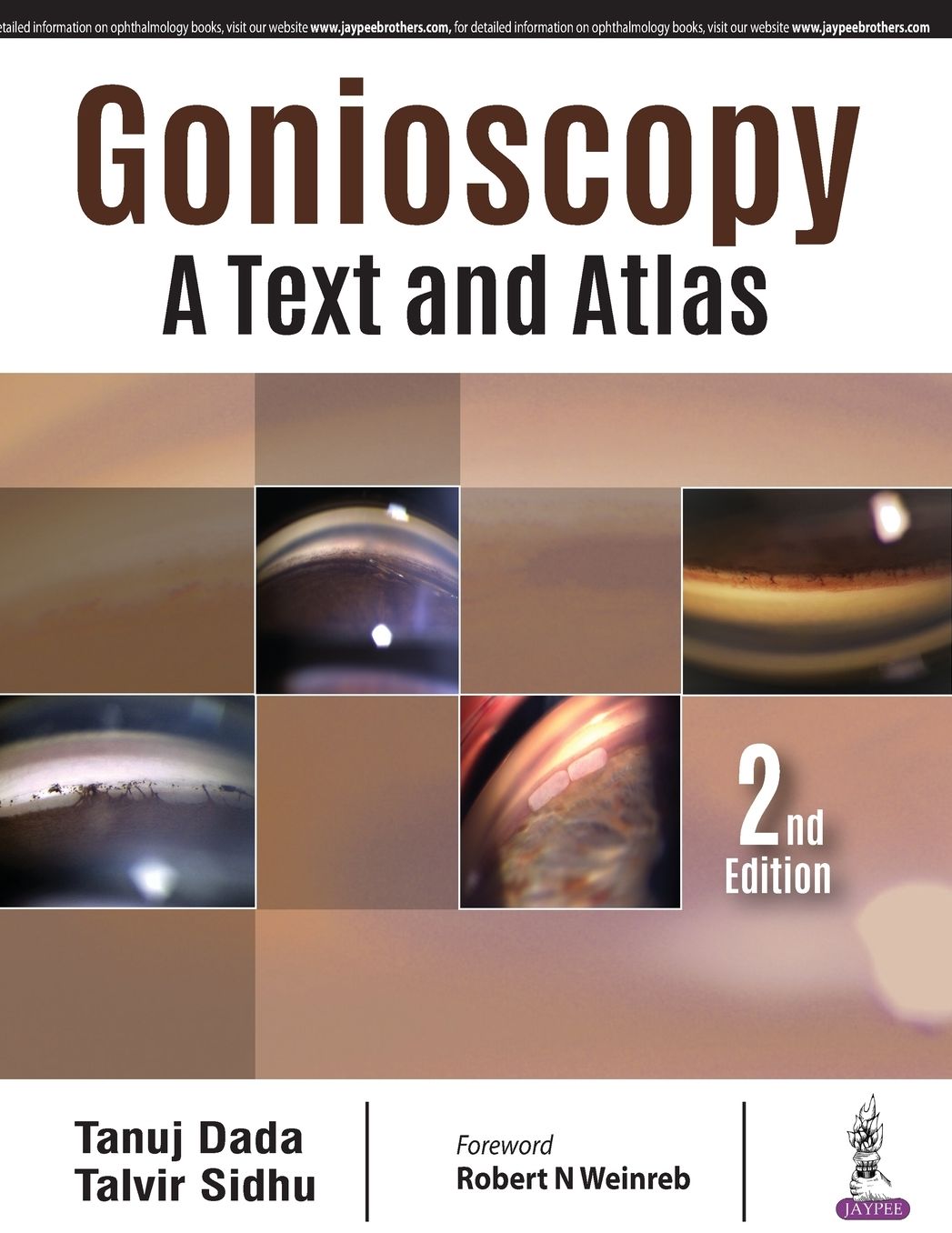 Gonioscopy : A Text and Atlas