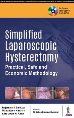 Simplified Laparoscopic Hysterectomy