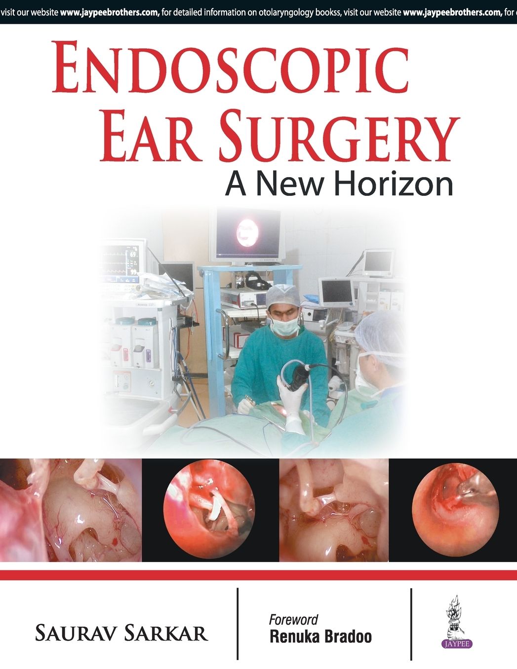 Endoscopic Ear Surgery a New Horizon