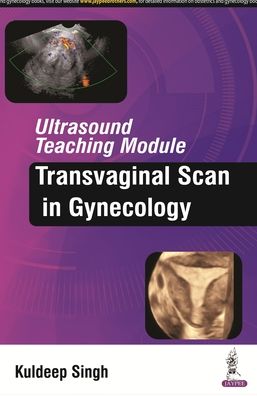 Ultrasound Teaching Module: Transvaginal Scan in Gynecology