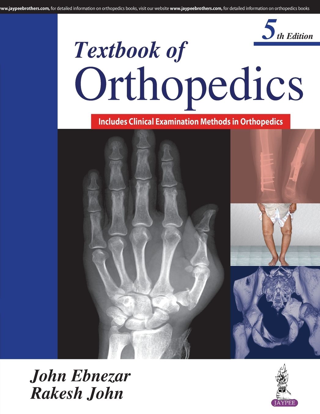 Textbook of Orthopedics : Includes Clinical Examination Methods in Orthopedics
