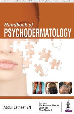 Handbook of Psychodermatology