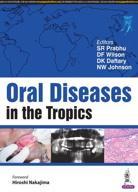 Oral Diseases in the Tropics