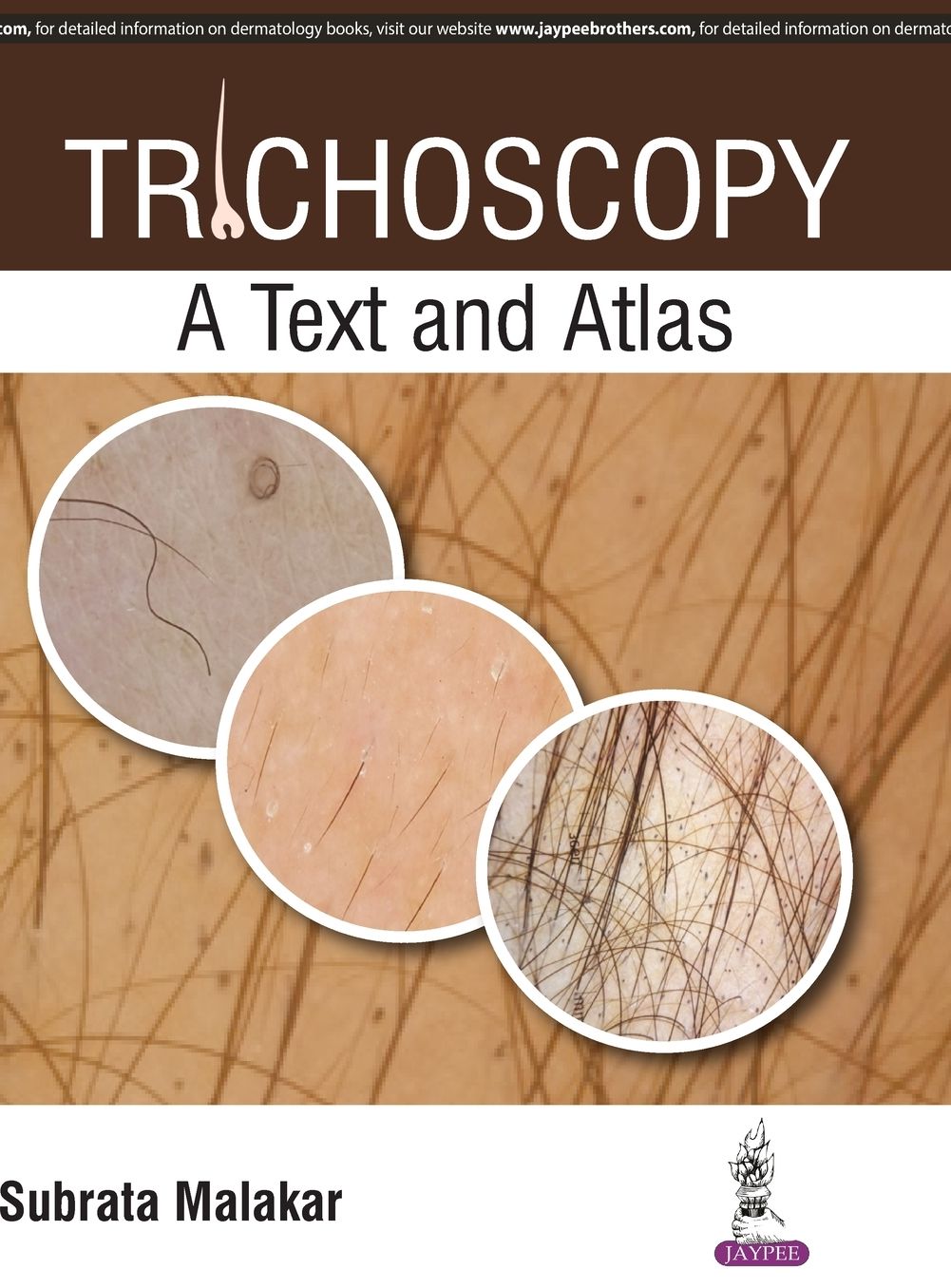 Trichoscopy : A Text and Atlas