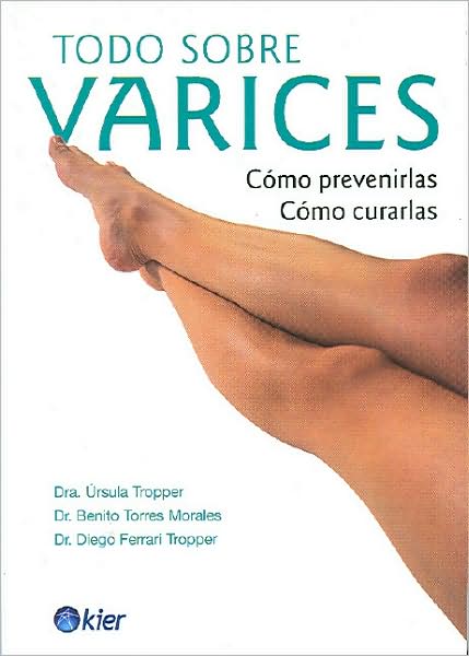Todo sobre várices
