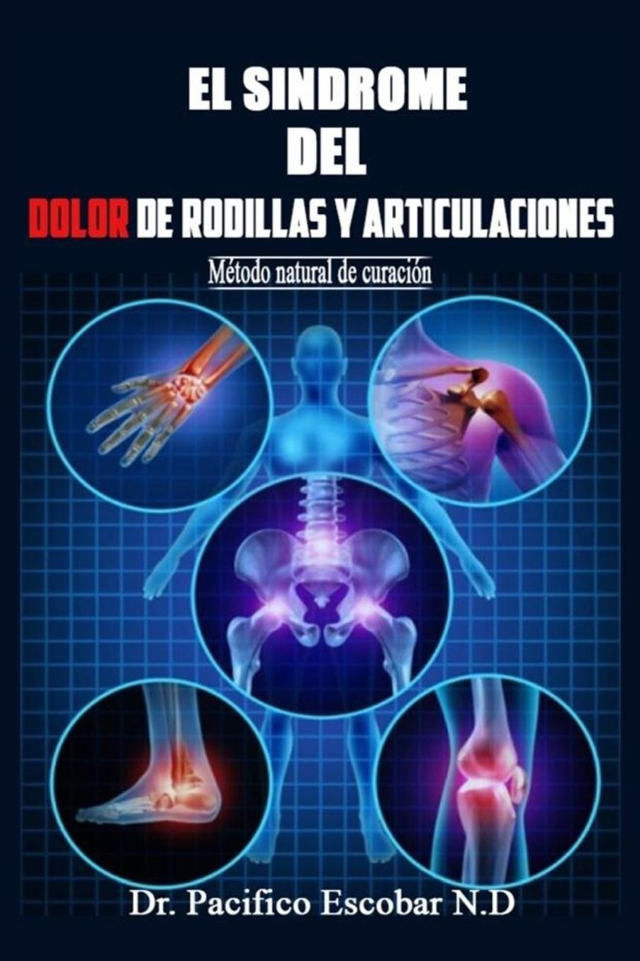 Sindrome del Dolor de Rodillas y Articulaciones: Metodo Natural de Curacion