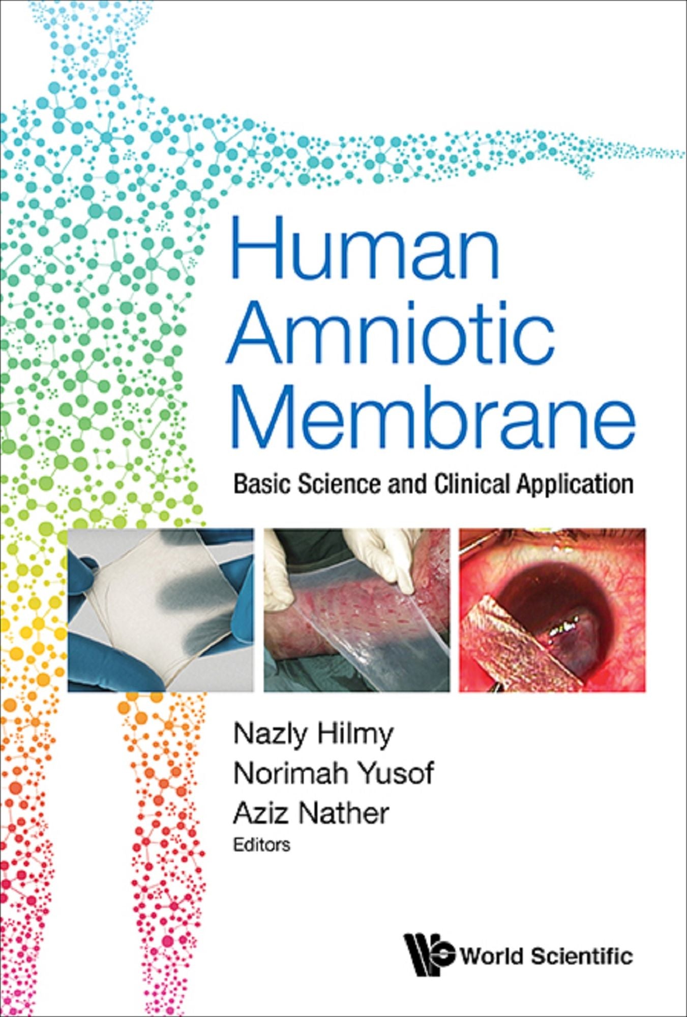 Human Amniotic Membrane: Basic Science And Clinical Application: Basic Science and Clinical Application