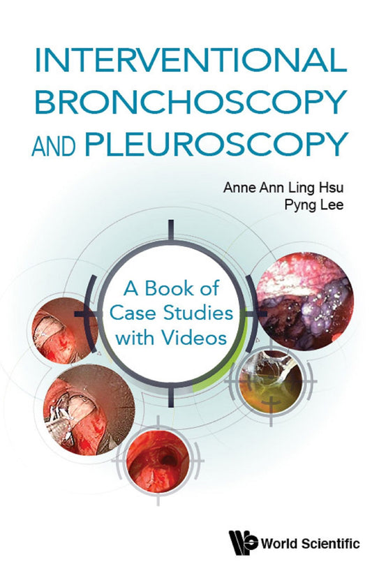Interventional Bronchoscopy and Pleuroscopy: A Book of Case Studies with Videos