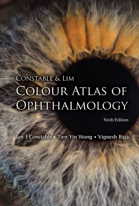 Colour Atlas of Ophthalmology (Sixth Edition)