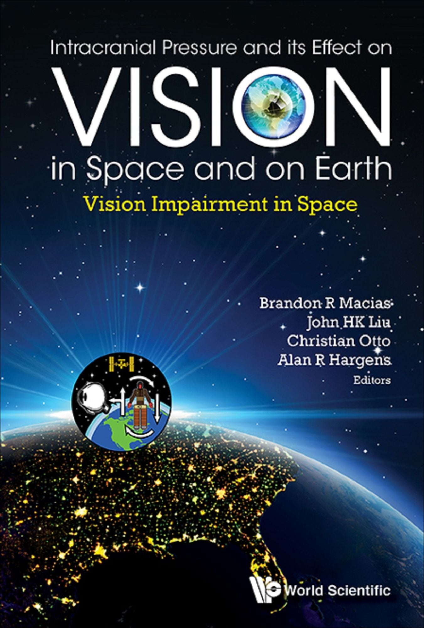 Intracranial Pressure and its Effect on Vision in Space and on Earth: Vision Impairment in Space