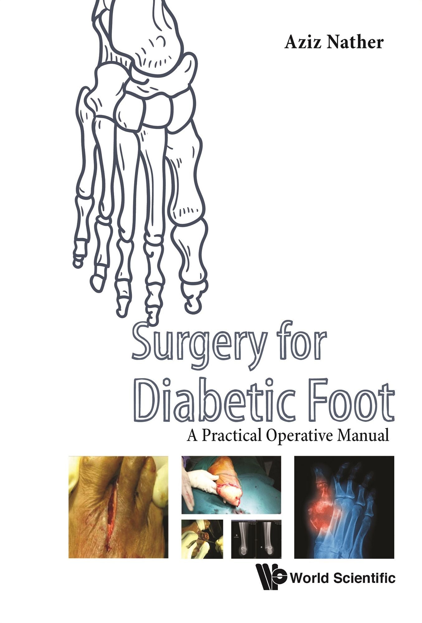 Surgery for Diabetic Foot: A Practical Operative Manual