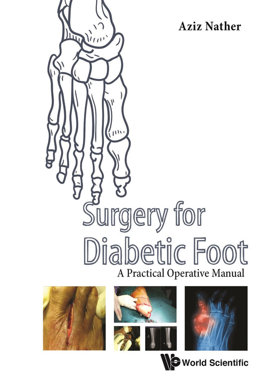 Surgery for Diabetic Foot: A Practical Operative Manual