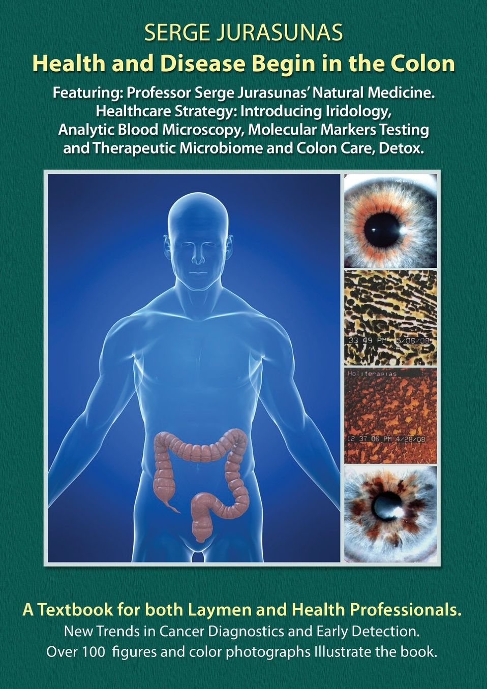 Health and Disease Begin in the Colon: Featuring: Professor Serge Jurasunas' Natural Medicine. Healthcare Strategy: Introducing Iridology, Analytic Blood Microscopy, Molecular Markers Testing and Therapeutic Microbiome and Colon Care, Detox.