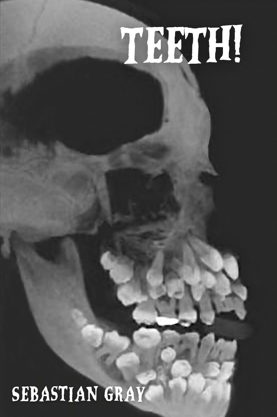Teeth!